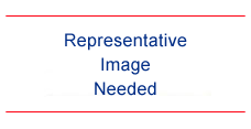 Representative Image Needed placeholder